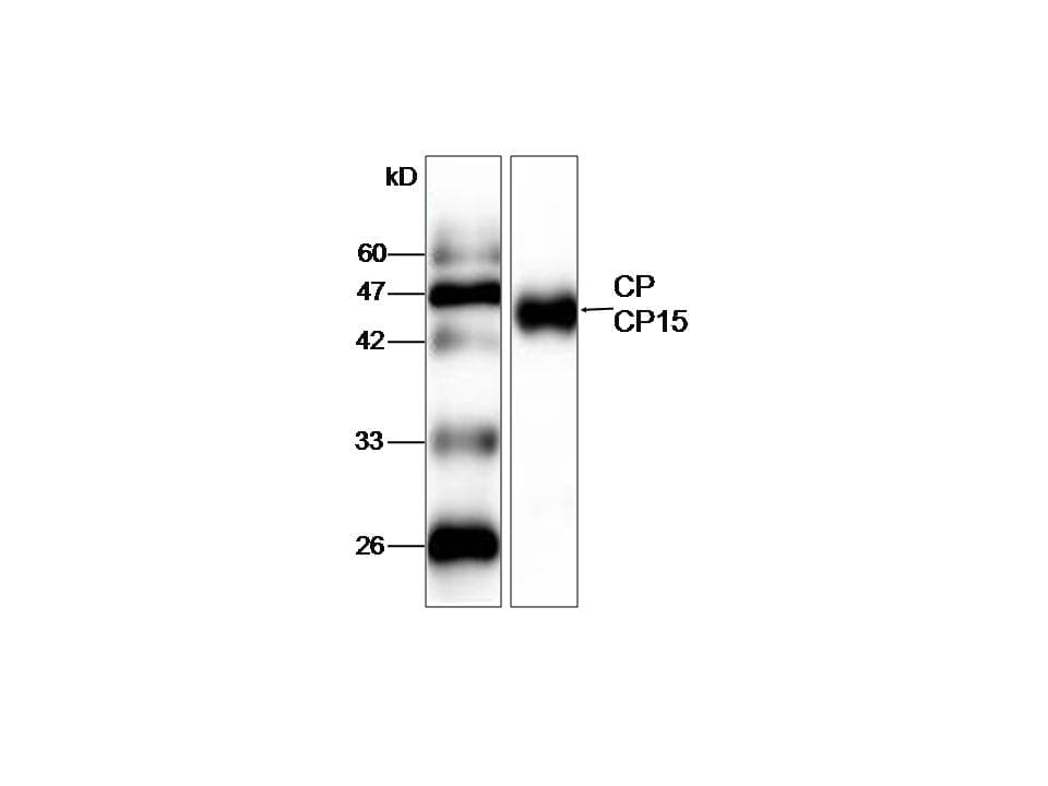 Monoclonal Mouse anti-Cryptosporidium Cryptosporidium CP15/60 Sporozoite 60K Protein Antibody (clone 15, aa9-156, WB)