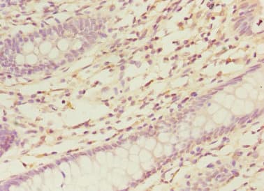 Polyclonal Rabbit anti-Human NELFB / COBRA1 Antibody (IHC, WB)