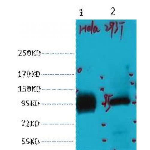 Monoclonal Mouse anti-Human ABCB5 Antibody (clone 11A2, WB)