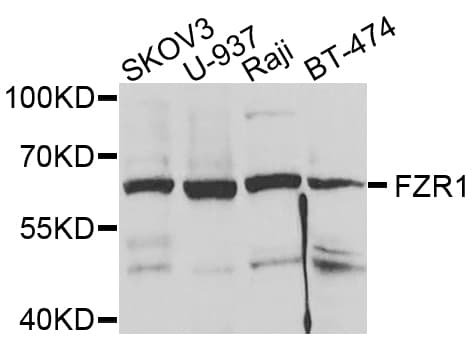 Polyclonal Rabbit anti-Human FZR1 Antibody (IHC, IF, WB)