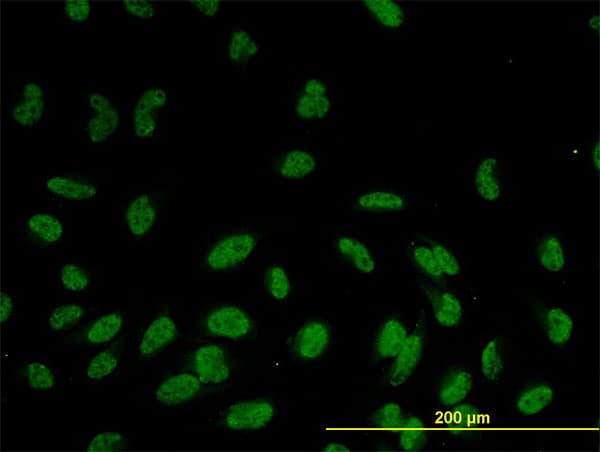 Monoclonal Mouse anti-Human RASSF8 Antibody (clone 2G1, IHC, IF, WB)