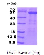 Human PDHX / Protein X / ProX (Recombinant His)