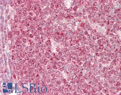 IHC-plus™ SYVN1 / HRD1 Antibody