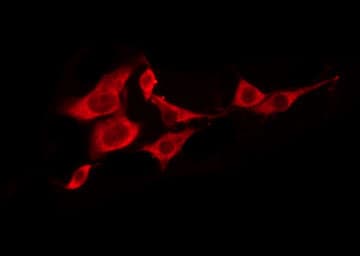 T2R5 / TAS2R5 Antibody