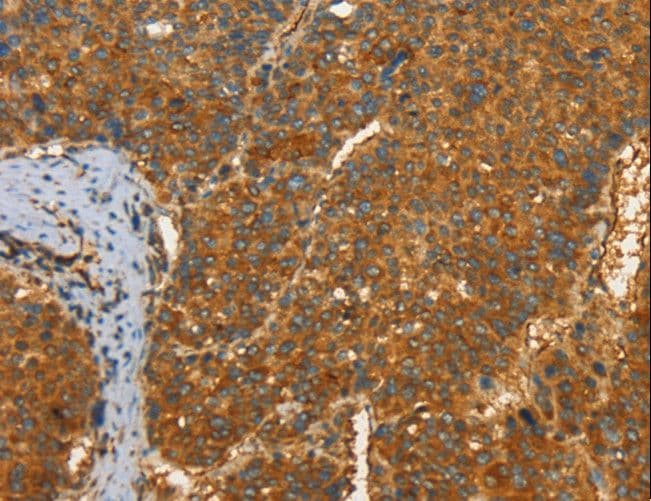 Polyclonal Rabbit anti-Human PFKFB1 Antibody (IHC)