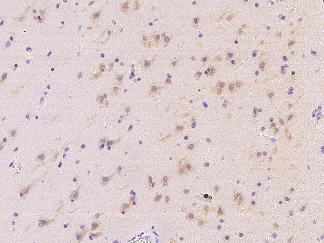 MRPS25 Antibody