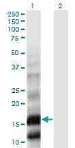 Monoclonal Mouse anti-Human PLA2G10 Antibody (clone 5G11, WB)