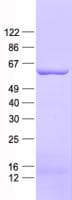 Human KRT6A / CK6A / Cytokeratin 6A Protein (Recombinant His, N-Terminal)