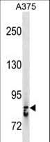 STAT3 Antibody (aa673-699)
