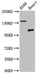 ADGRA2 / GPR124 Antibody