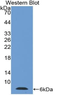 TMSB4X / Thymosin Beta-4 Antibody (aa1-44, Biotin)