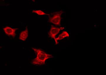 CNR1 / CB1 Antibody