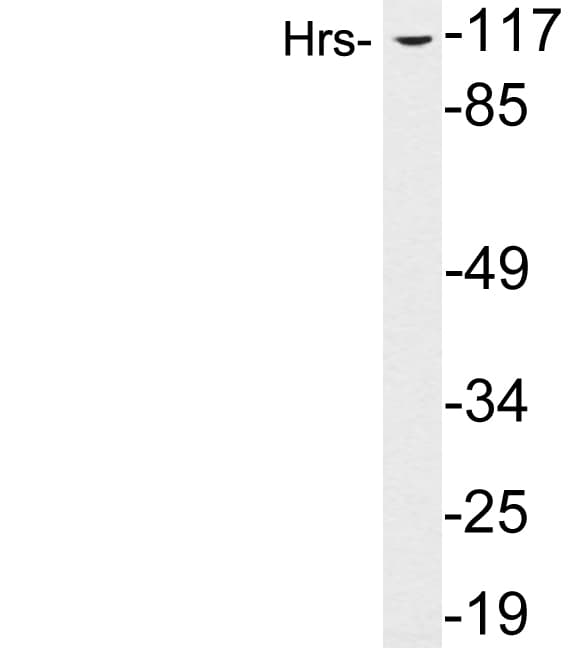 HRS / HGS Antibody (aa164-213)