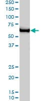 Monoclonal Mouse anti-Human TFB1 / GTF2H1 Antibody (clone 1F12-1B5, IF, WB)