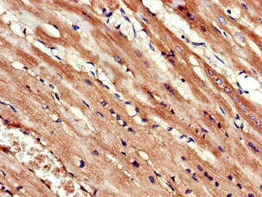 KIF14 Antibody