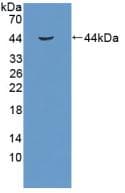 RB1 / Retinoblastoma / RB Antibody (aa639-778, PE)