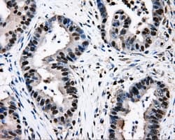 RIP1 / RALBP1 Antibody (clone OTI6C6)