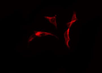 COL25A1 / Collagen XXV Antibody
