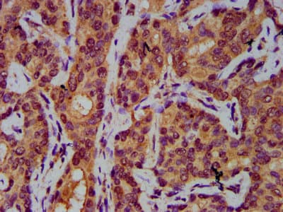 AASS / LKR / SDH Antibody
