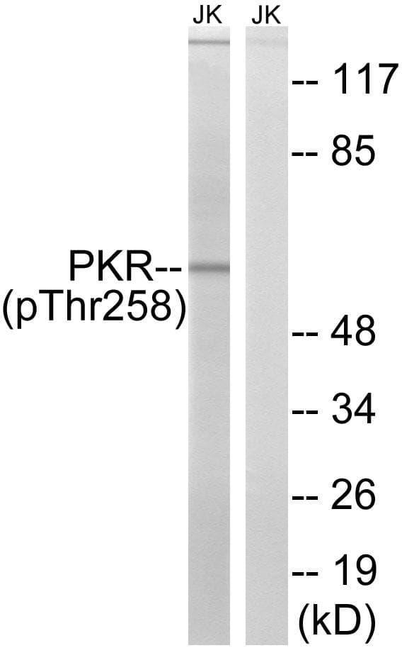 PRKRIR Antibody (phospho-Thr258)