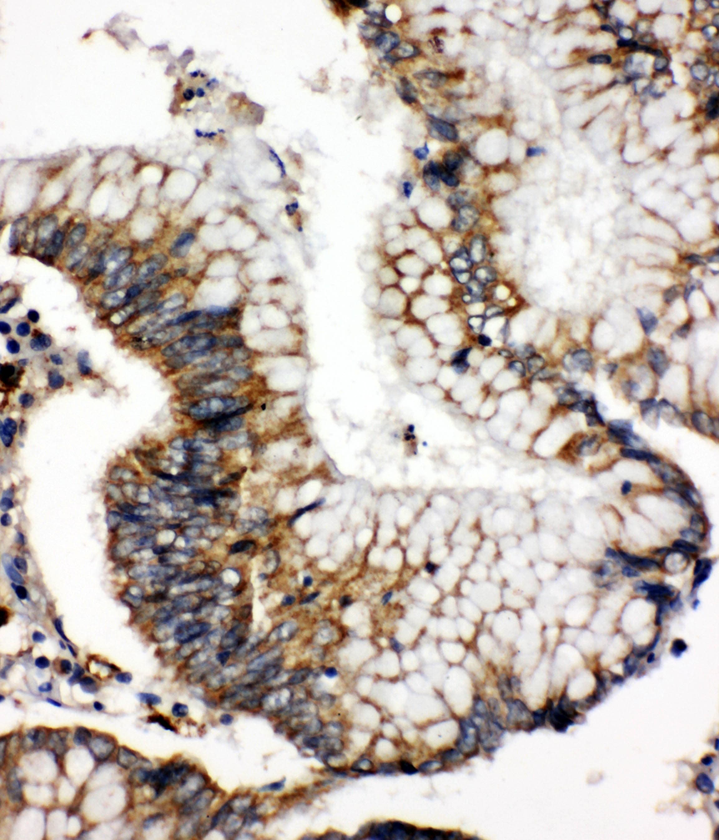 Polyclonal Rabbit anti-Human SOD2 / Mn SOD Antibody (aa45-62, IHC, WB)