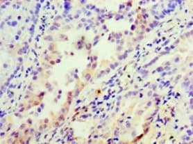 INHBA / Inhibin Beta A Antibody