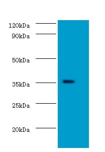 DOK5 Antibody (Biotin)