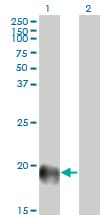 ESM1 / Endocan Antibody (clone 6D4)