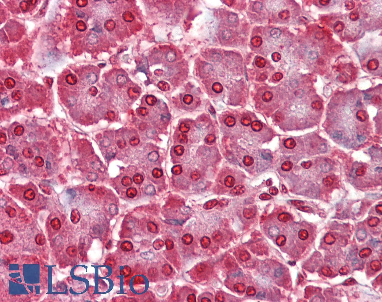 IHC-plus™ Polyclonal Rabbit anti-Human CASP12 / Caspase 12 Antibody (IHC, IF, WB)