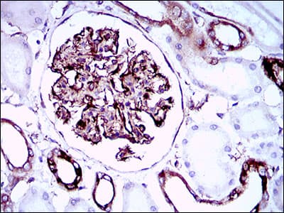 Monoclonal Mouse anti-Human SYCP3 / SCP3 Antibody (clone 6F9C5, aa27-128, IHC, IF, WB)