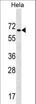 Zfp105 / ZNF35 Antibody (aa152-181)