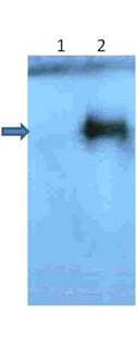 APP / Beta Amyloid Precursor Antibody (Pyro-Glu3)