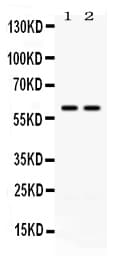 Polyclonal Rabbit anti-Human CCT3 Antibody (IHC, WB)
