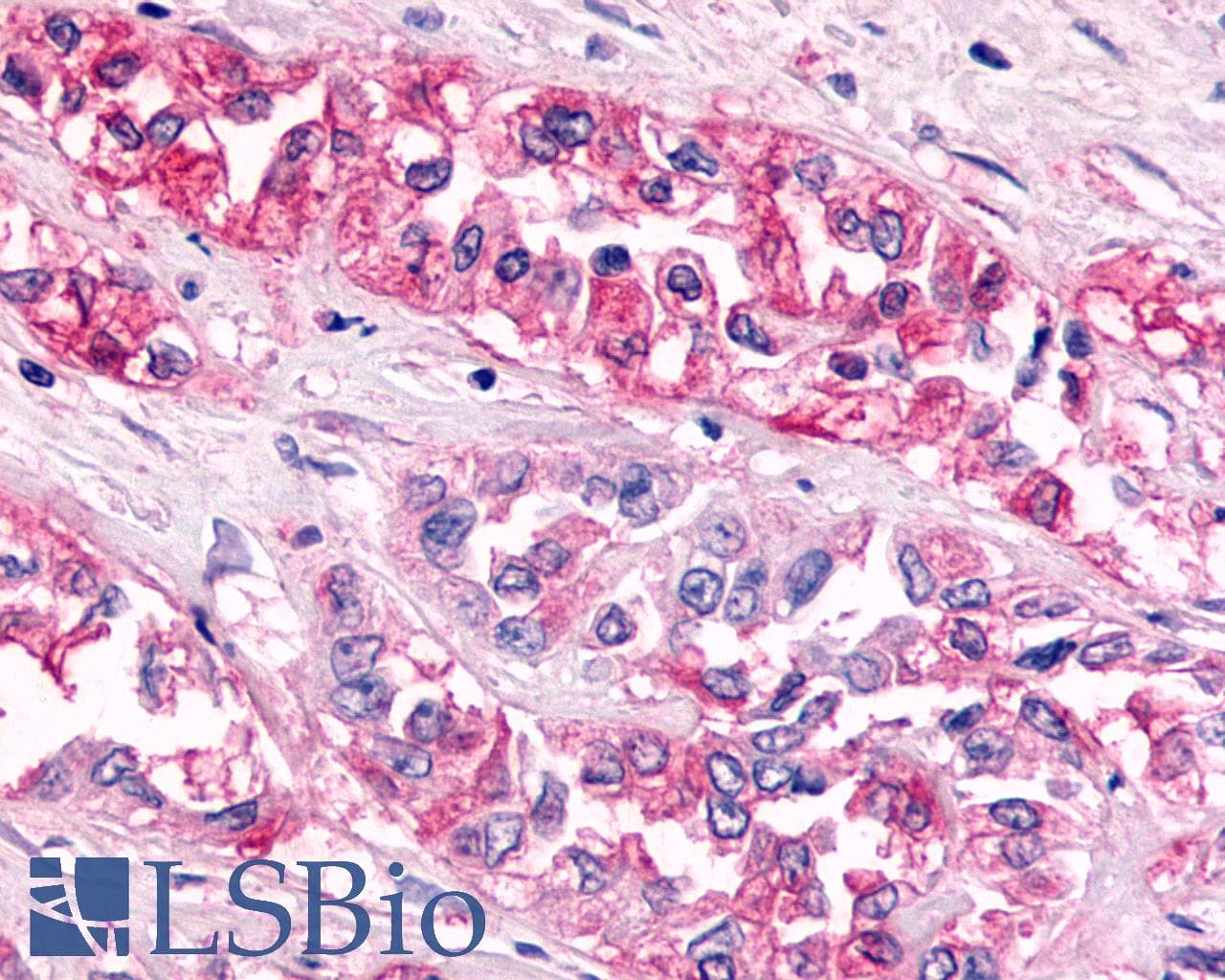 PathPlus™ GPR119 Antibody (Cytoplasmic Domain)