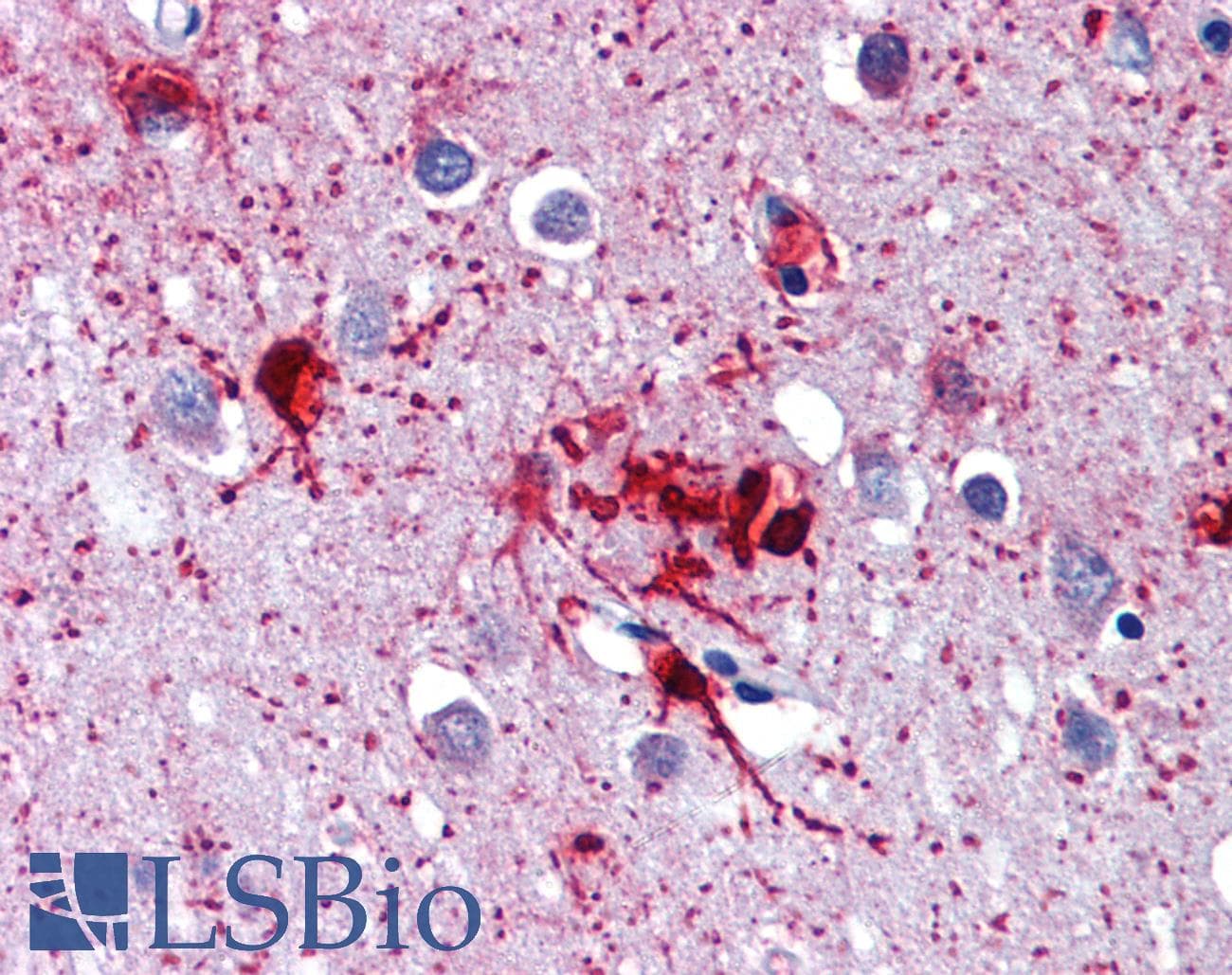 IHC-plus™ DDX58 / RIG-1 / RIG-I Antibody (C-Terminus)