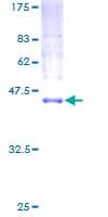 Human MCFD2 Protein (Recombinant GST)