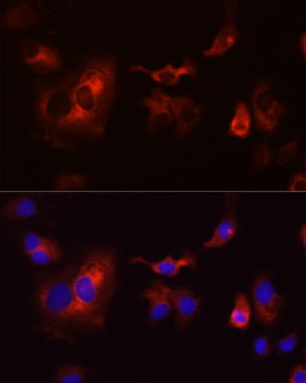 CYBB / NOX2 / gp91phox Antibody