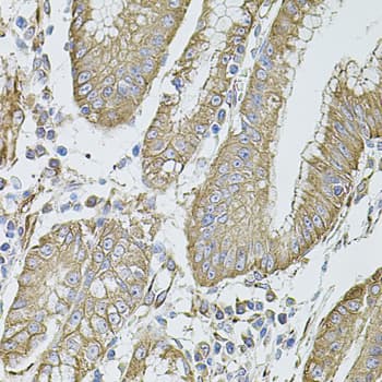 FLNB / TAP Antibody