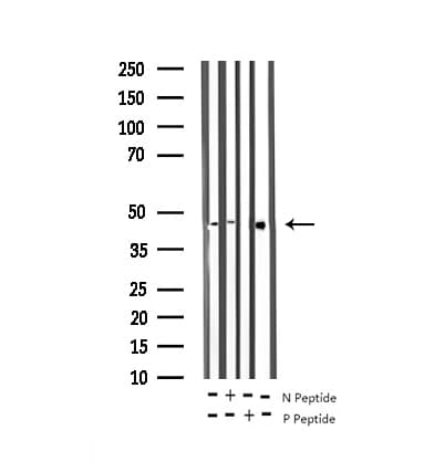 MAP2K1 / MKK1 / MEK1 Antibody (phospho-Ser221)