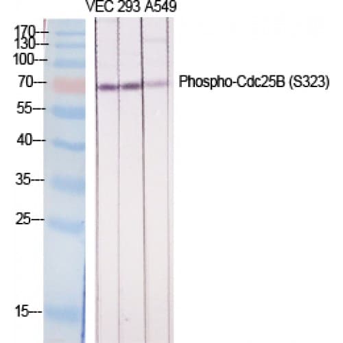 Polyclonal Rabbit anti-Human CDC25B Antibody (260-340 aa, WB)