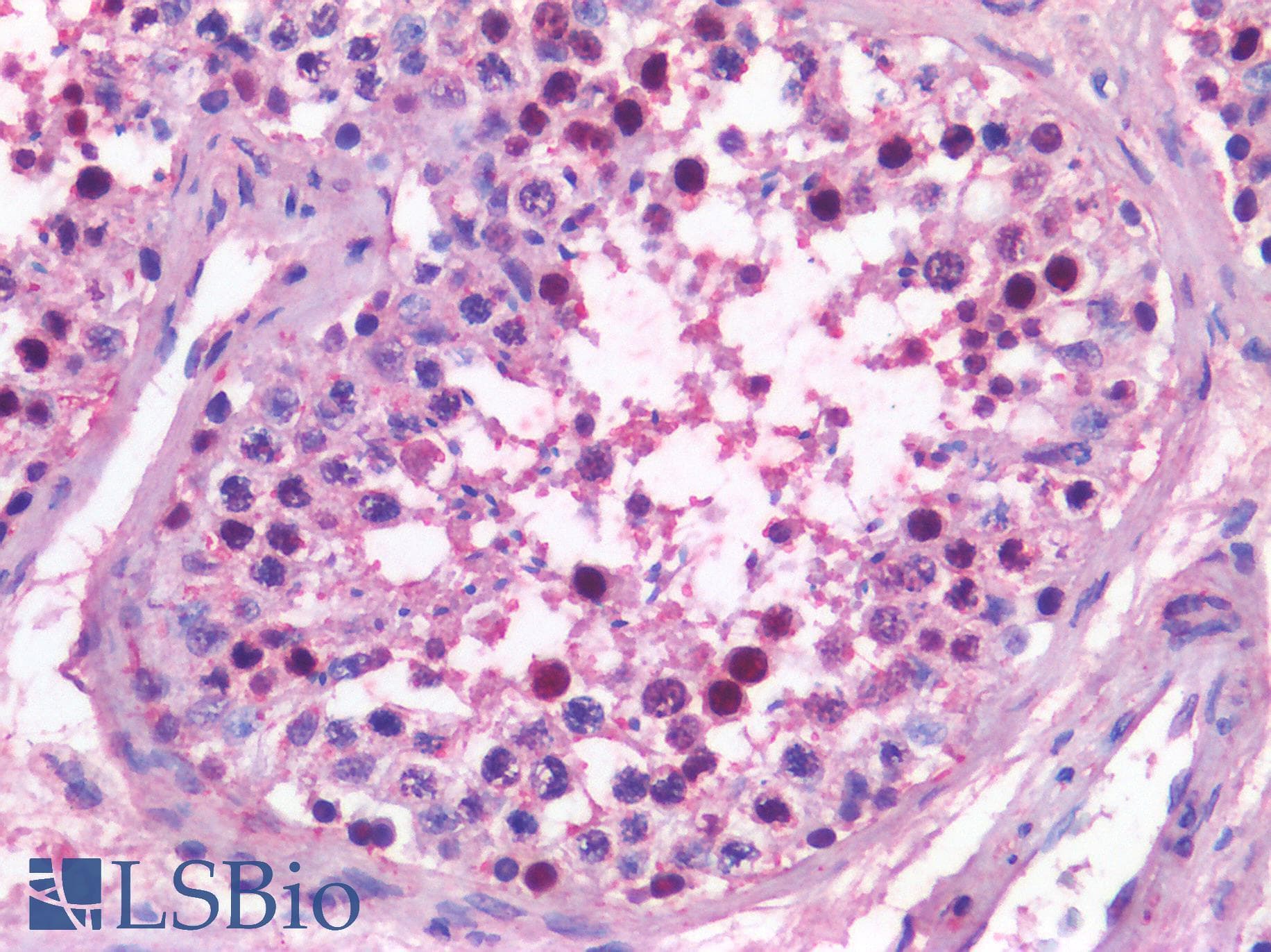 PathPlus™ NR5A1 / SF1 Antibody (Internal)