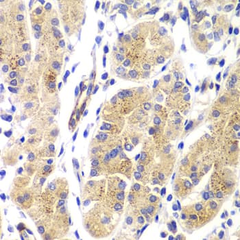 IHC-plus™ HRAS / H-Ras Antibody