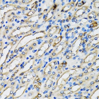 Polyclonal Rabbit anti-Human COPB2 / Beta-COP Antibody (IHC, IF, WB)