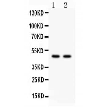 Polyclonal Rabbit anti-Human SOX4 Antibody (aa1-31, WB)