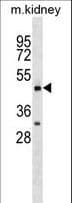 Polyclonal Rabbit anti-Human OX2R / Orexin Receptor 2 Antibody (aa275-304, WB)