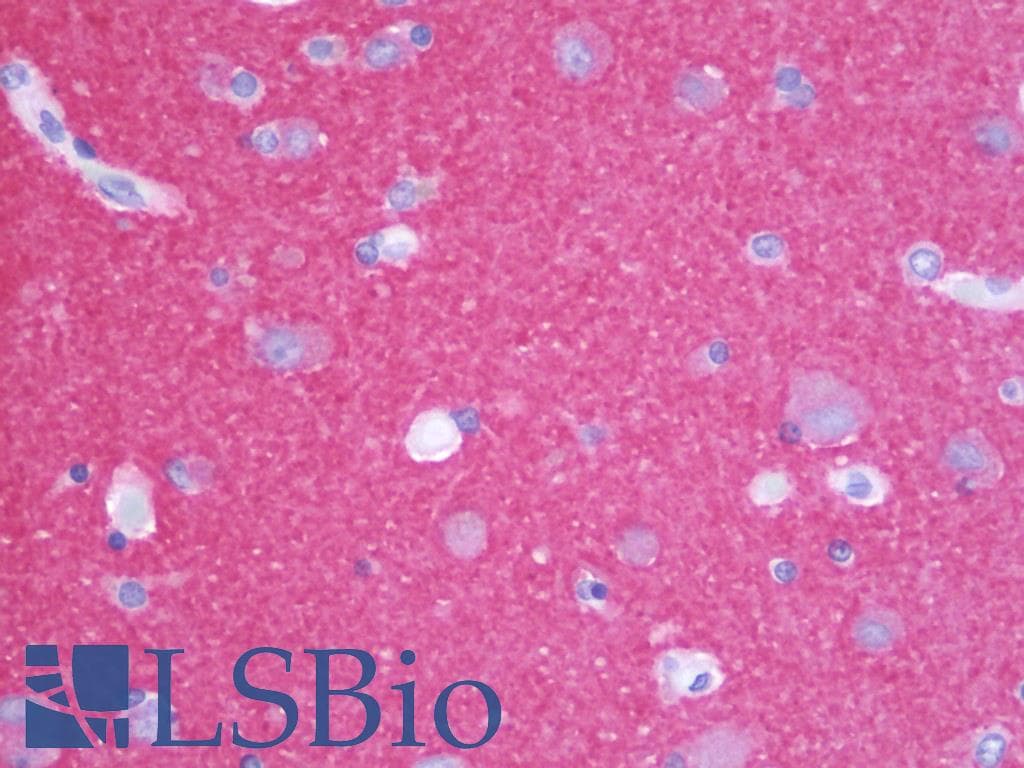 IHC-plus™ Rab3 Antibody (C-Terminus)