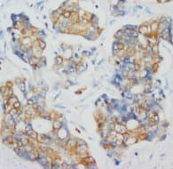 IHC-plus™ Monoclonal Mouse anti-Human KRT18 / CK18 / Cytokeratin 18 Antibody (clone CK-18, IHC, WB)