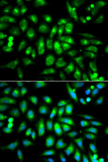 CHRM2 / M2 Antibody