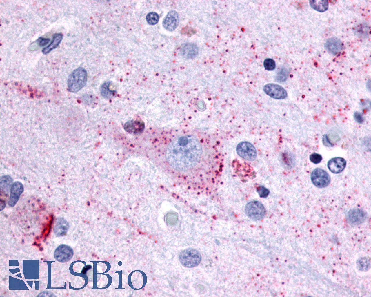 PathPlus™ Polyclonal Rabbit anti-Human MRGPRX3 / MRGX3 Antibody (Extracellular Domain, IHC)