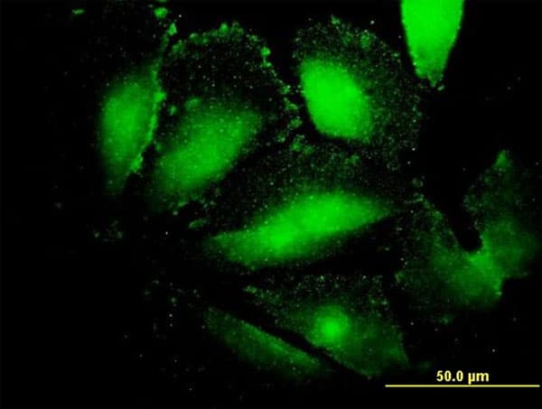 Monoclonal Mouse anti-Human Alpha-Fetoprotein Antibody (clone 1G7, IF, WB)